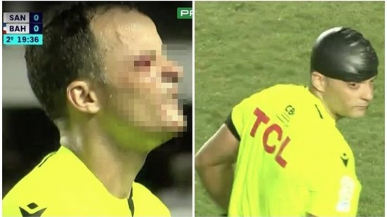Reprodução