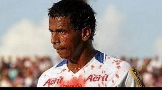 Imagem Ex-Bahia não renova e deixa a Jacuipense