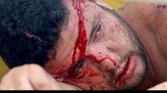 Imagem Confronto entre torcidas deixa torcedores gravemente feridos