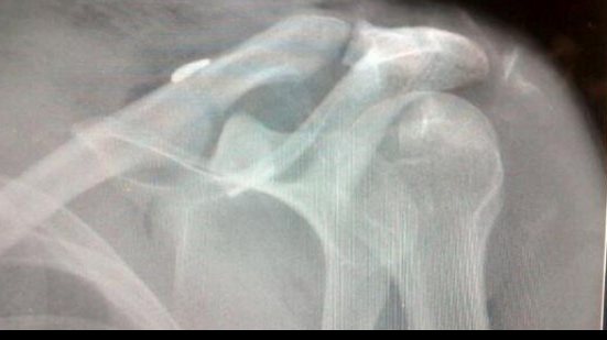 Imagem Cirurgia de lateral-direito do Bahia é um sucesso
