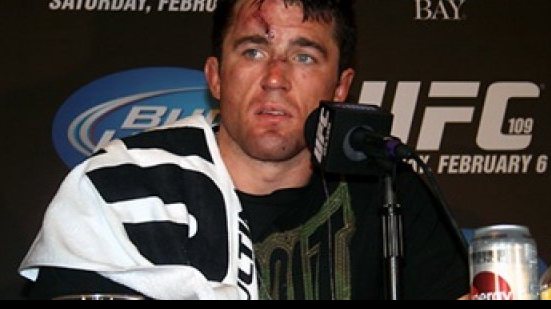 Imagem Chael Sonnen surpreende e anuncia aposentadoria