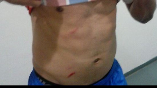 Imagem Maxi mostra marcas das travas da chuteira de zagueiro corinthiano