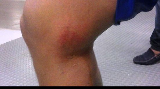 Imagem Uelliton mostra resultado da entrada de Emerson Sheik: “maldoso”
