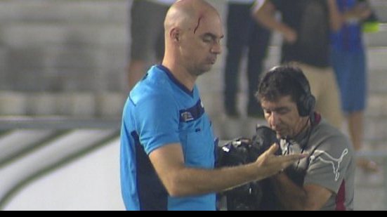 Imagem Campinense é punido pelo STJD após objeto atingir árbitro em duelo com o Bahia