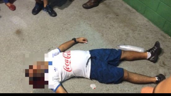 Imagem Após jogo, confusão em bar da Arena deixa torcedor desmaiado e sangrando