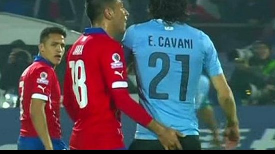 Imagem Por &#039;dedada&#039; em Cavani, jogador chileno está fora da Copa América 