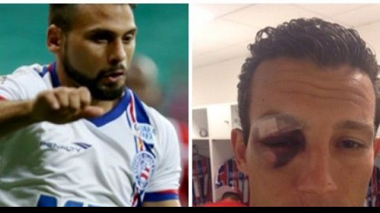 Imagem Maxi Biancucchi e zagueiro são dúvidas no Bahia para duelo com o Sampaio Corrêa