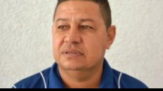 Imagem Após eliminação na Série D, Colo Colo demite Gilmey Aimbere