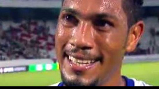 Imagem Agredido no primeiro tempo contra o Santa, Hernane evita comentar arbitragem