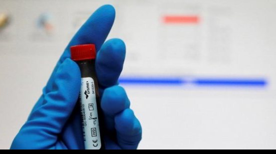 Imagem Doping tira Rússia dos Jogos Paralímpicos do Rio