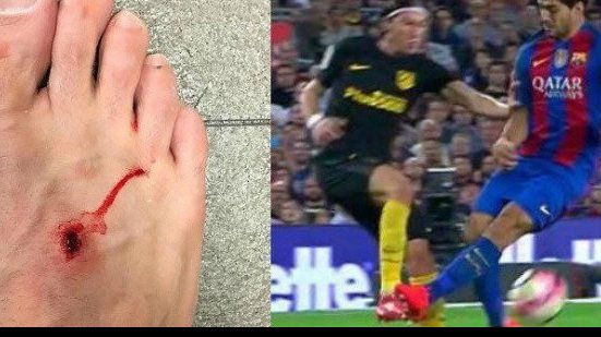 Imagem Após entrada dura, Suárez responde Filipe Luís: "Futebol é para homens"