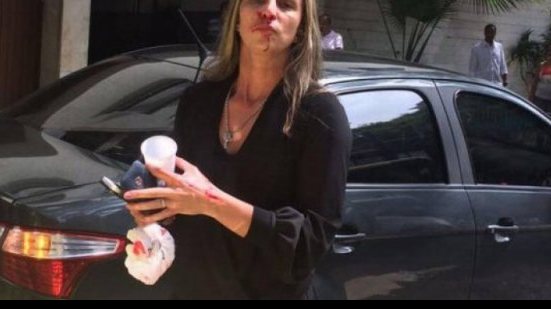Imagem Jogadora de vôlei diz ter sido espancada por taxista