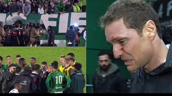 Imagem Cruzeiro elimina a Chapecoense e partida termina em pancadaria
