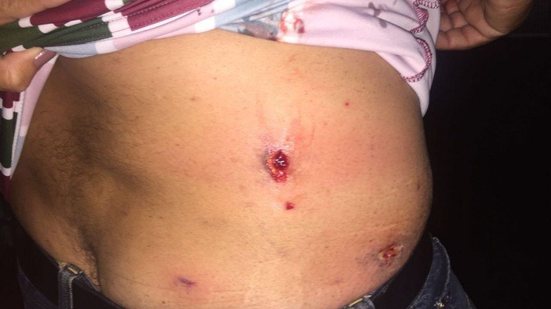 Imagem Torcedor do Flu acusa torcedores do Bahia de agressão: jogaram bomba na gente
