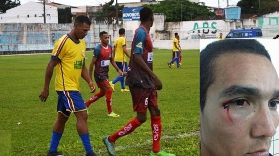 Imagem Vídeo: jogadores de Vera Cruz agridem árbitro em jogo o Intermunicipal