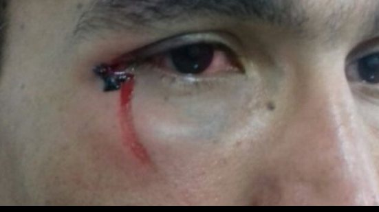 Imagem “Todos vão pagar”, afirma árbitro agredido com socos e pontapés no Intermunicipal 