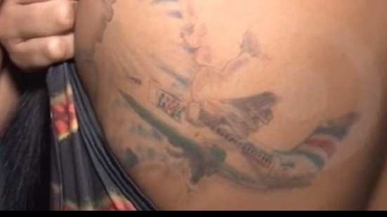 Imagem Sobrevivente de tragédia da Chapecoense faz tatuagem do avião em homenagem às vítimas