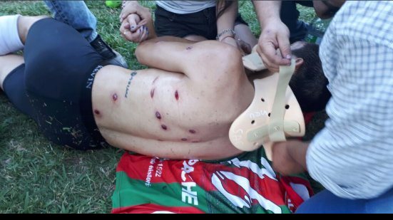 Imagem Cenas Lamentáveis! Jogadores tomam tiro de bala de borracha da polícia na Argentina