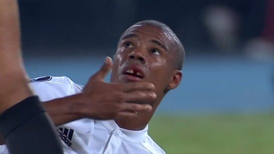 Imagem Meia do River Plate leva cotovelada de jogador do Flamengo e perde dente